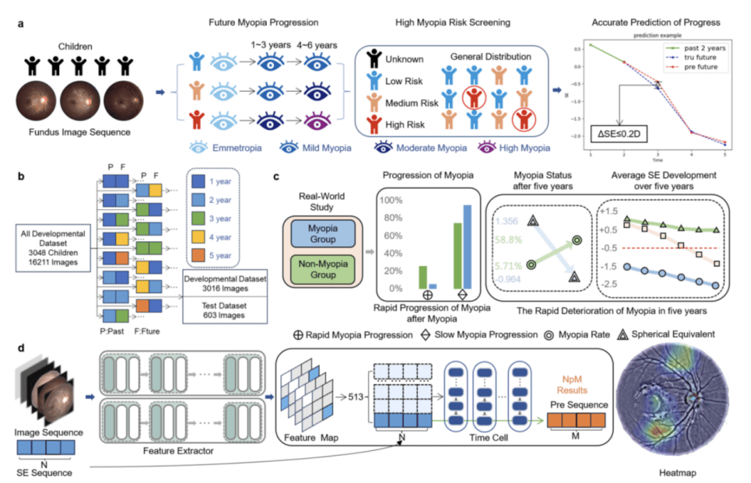 王宁利李仕明付晶高硕团队重磅成果：JAMA子刊儿童近视预测新突破